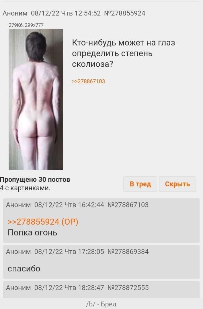 Аноним 08/12/22 Чтв 12:54:52 №278855924 5 Кто-нибудь может на глаз определить степень сколиоза? >>278867103 Пропущено 30 постов 4 с картинками. В тред Скрыть Аноним 08/12/22 Чтв 16:42:44 №278867103 >>