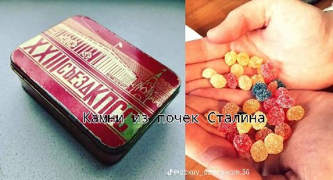 277 из почек Ста на,