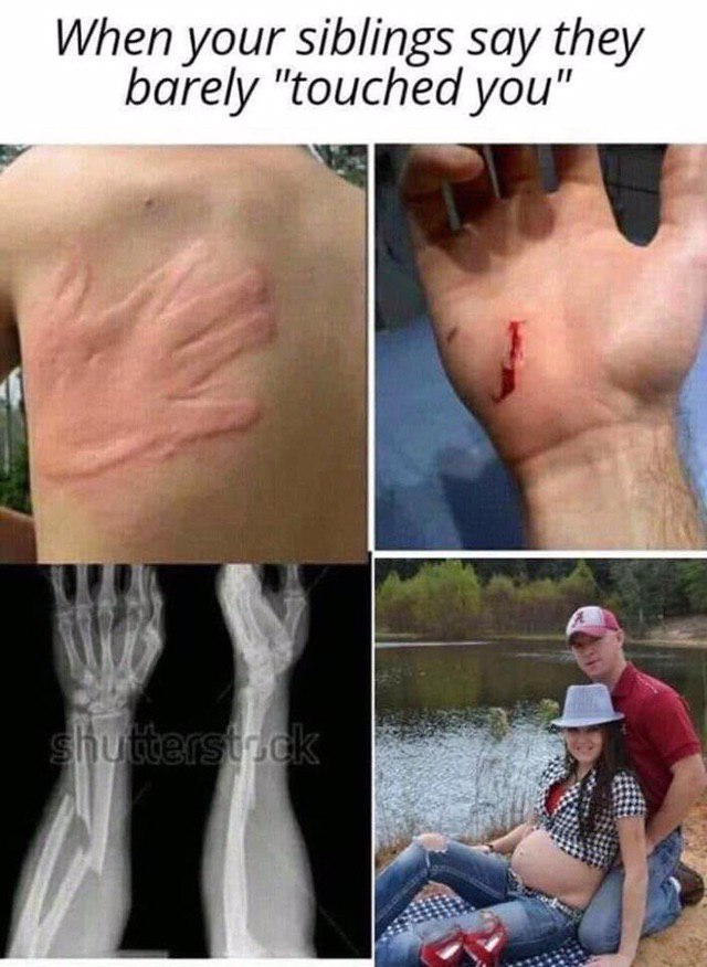 When your siblings say they barely "touched you"