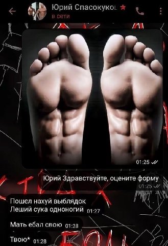 Юрий Спасокуко: 9 01:25 Юрий Здравствуйте, оцените форму Пошел нахуй выблядок Леший сука одноногий 93-27 Мать ебал свою 91-28