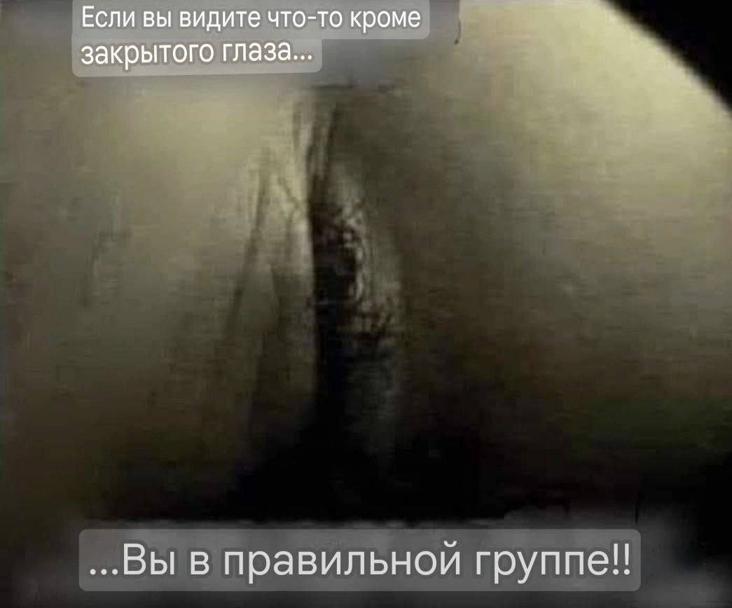 Если вы видите что-то кроме закрытого глаза... ...Вы в правильной группе!!