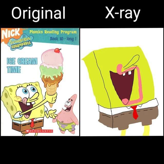 Original X-ray