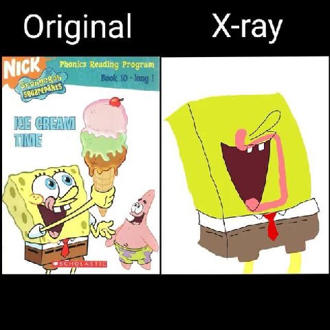 Original X-ray