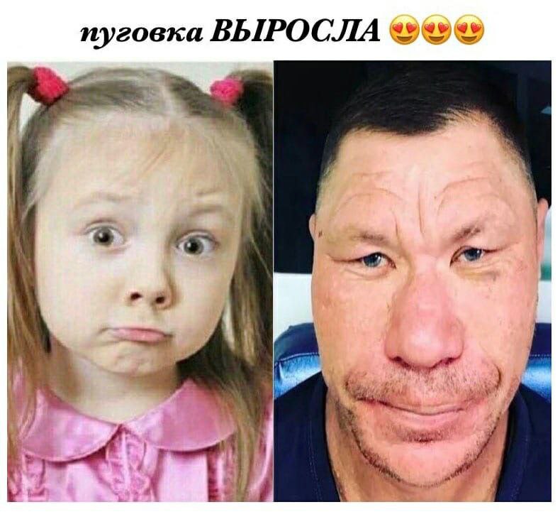 пуговка ВЫРОСЛА ray