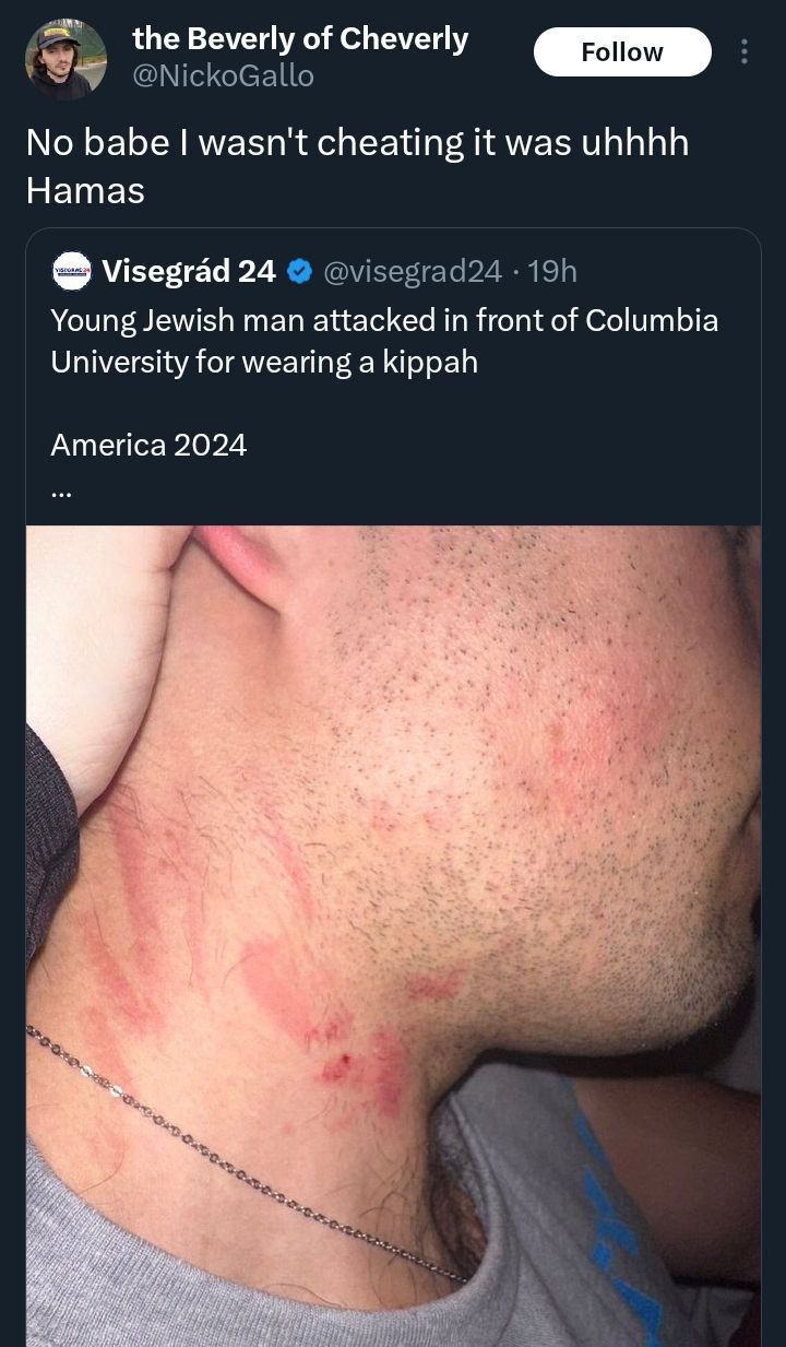 the Beverly of Cheverly @NickoGallo No babe wasn't cheating it was uhhhh Hamas Visegrad 24 @visegrad24 Young Jewish man attacked in front of Columbia University for wearing a kippah America 2024 he