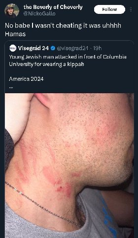 the Beverly of Cheverly @NickoGallo No babe wasn't cheating it was uhhhh Hamas Visegrad 24 @visegrad24 Young Jewish man attacked in front of Columbia University for wearing a kippah America 2024 he