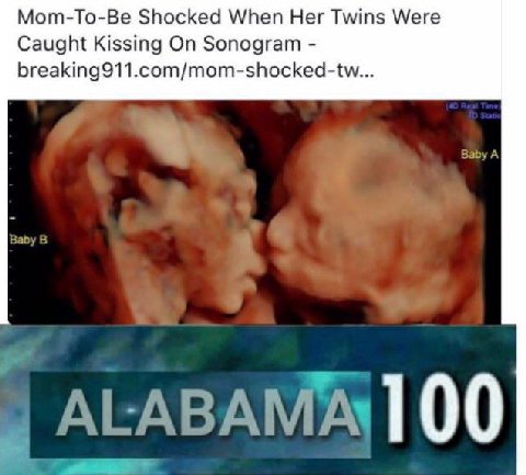 Мот-То-Ве Shocked When Her Twins Were Caught Kissing On Sonogram breaking911.com/mom-shocked-tw... 00