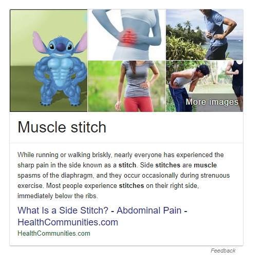 у More images Muscle stitch While running or walking briskly, nearly everyone has experienced the sharp pain in the side known as a stitch. Side stitches are muscle spasms of the diaphragm, and they o