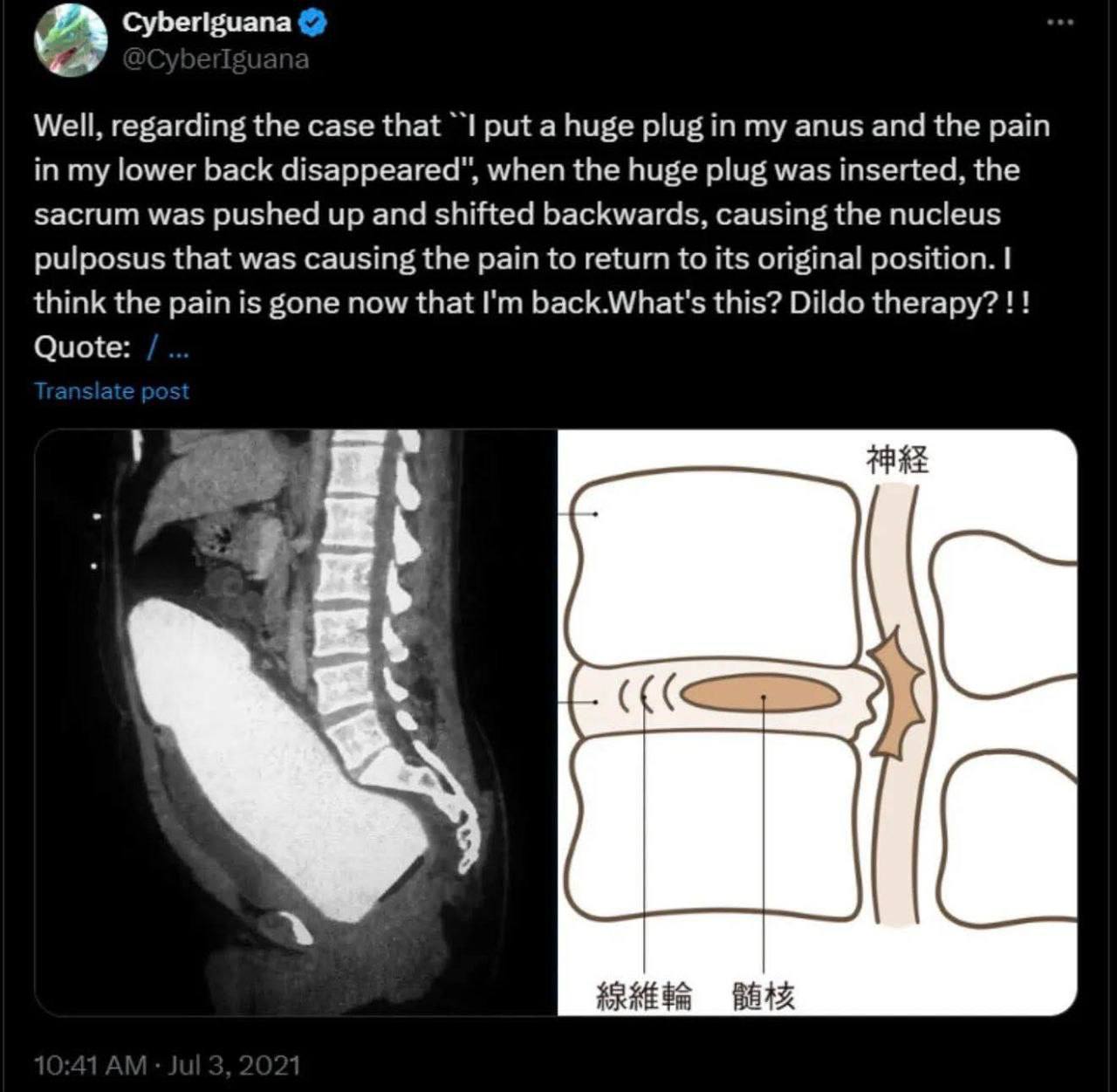 new developments in therapeutic dildonics