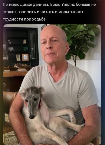 По имеющимся данным, Брюс Уиллис больше не может говорить и читать и испытывает трудности при ходьбе.