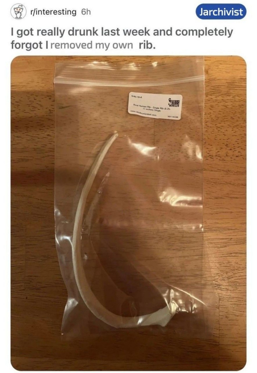 r/interesting got really drunk last week and completely forgot removed my own rib.