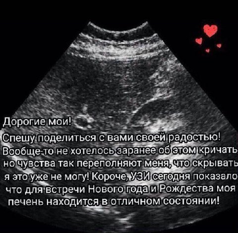 Дорогие мои! Спешу поделиться с вами своей радостью! Вообще-то не хотелось. заранёе об'этом. ‚кричать чувства так переполняют меня: что скрывать я уже не могу! „Сегодня! показало что для встречи Новог