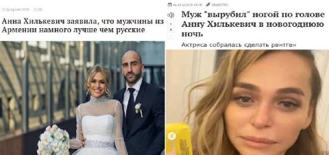 [5 "вырубил" ногой по голове Анна Хилькевич заявила, что мужчины из Анну Хилькевич в новогоднюю Армении намного лучше чем русские ночь Актриса собралась сделать рентген 4 у 34