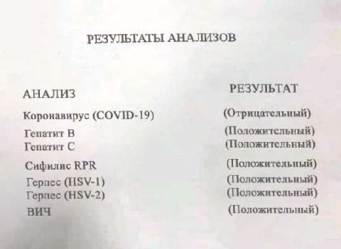 РЕЗУЛЬТАТЫ АНАЛИЗОВ РЕЗУЛЬТАТ АНАЛИЗ (Отрицательный) Коронавирус (COVID-19) Гепатит В (Положительный) Гепатит С (Положительный) Сифилис КРК (Положительный) Герпес (HSV-1) (Положительный) ‚(Н$У-2) (Пол