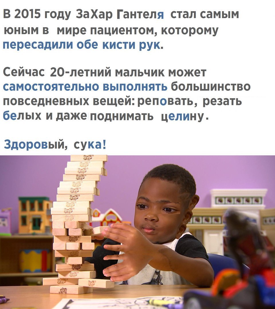 В 2015 году ЗаХар Гантеля стал самым юным в мире пациентом, которому пересадили обе кисти рук. Сейчас 20-летний мальчик может самостоятельно выполнять большинство повседневных вещей: реповать, резать 