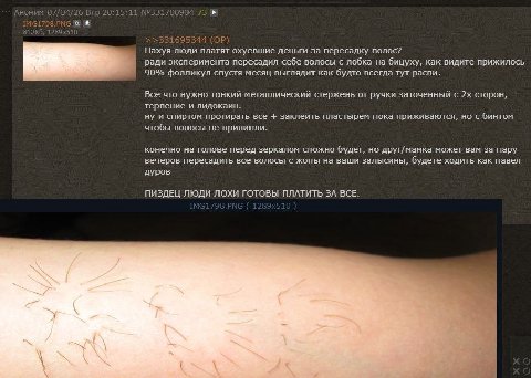 67/04/26 20:15:11 73 Нахуя люди платят охуевшие деньги за пересадку волос? ради эксперимента пересадил себе волосы с лобка на бицуху, как видите прижилось 90% фолликул спустя месяц выглядит как будто 