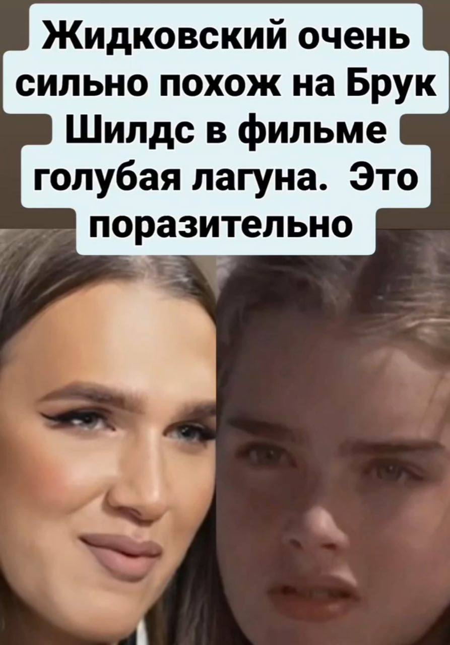 Жидковский очень сильно похож на Брук Шилдс в фильме голубая лагуна. Это поразительно