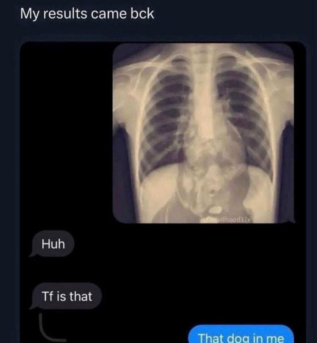 My results came bck Huh is that