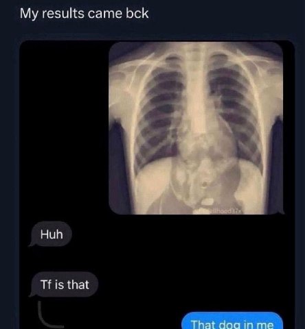 My results came bck Huh is that
