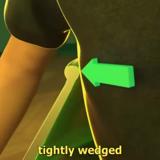 tightly wedged