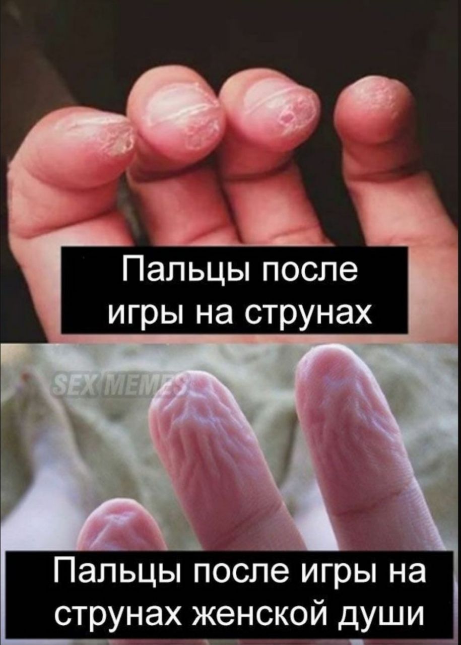 Пальцы после игры на струнах Пальцы после игры на струнах женской души