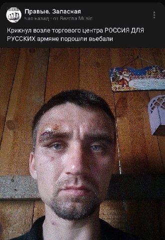 Правые. Запасная час назад от Bezdna Music Крикнул возле торгового центра РОССИЯ ДЛЯ РУССКИХ армяне подошли вьебали 7 a 4