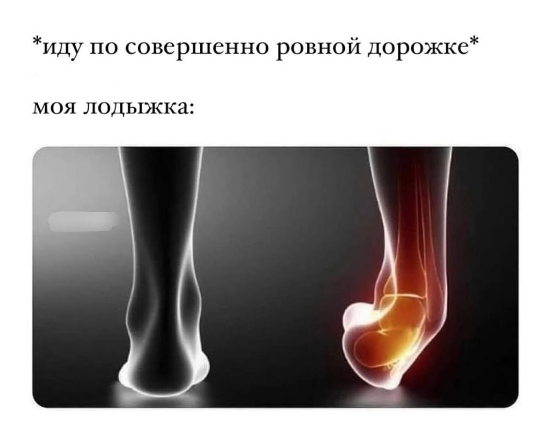 *иду по совершенно ровной дорожке* моя лодыжка: