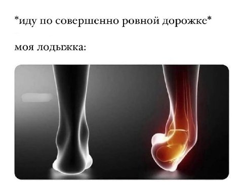 *иду по совершенно ровной дорожке* моя лодыжка: