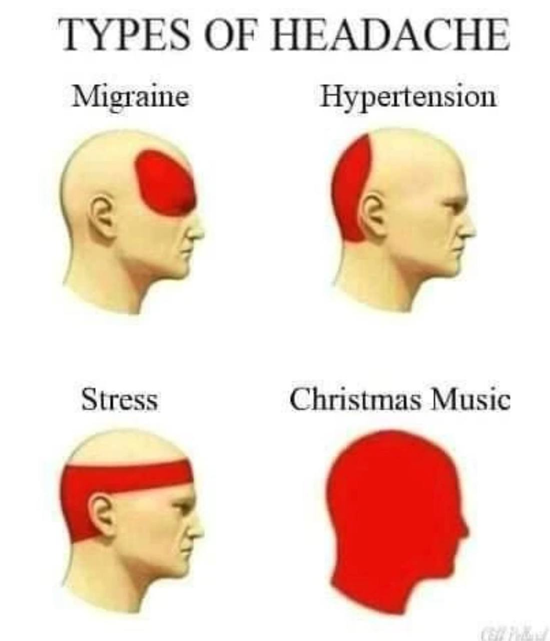 TYPES OF HEADACHE Migraine Hypertension У a Stress Christmas Music