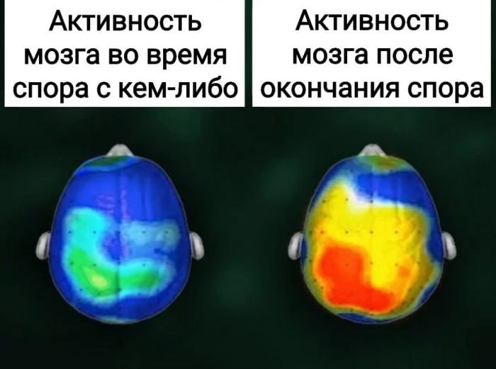 Активность Активность мозга во время мозга после спора с кем-либо окончания спора