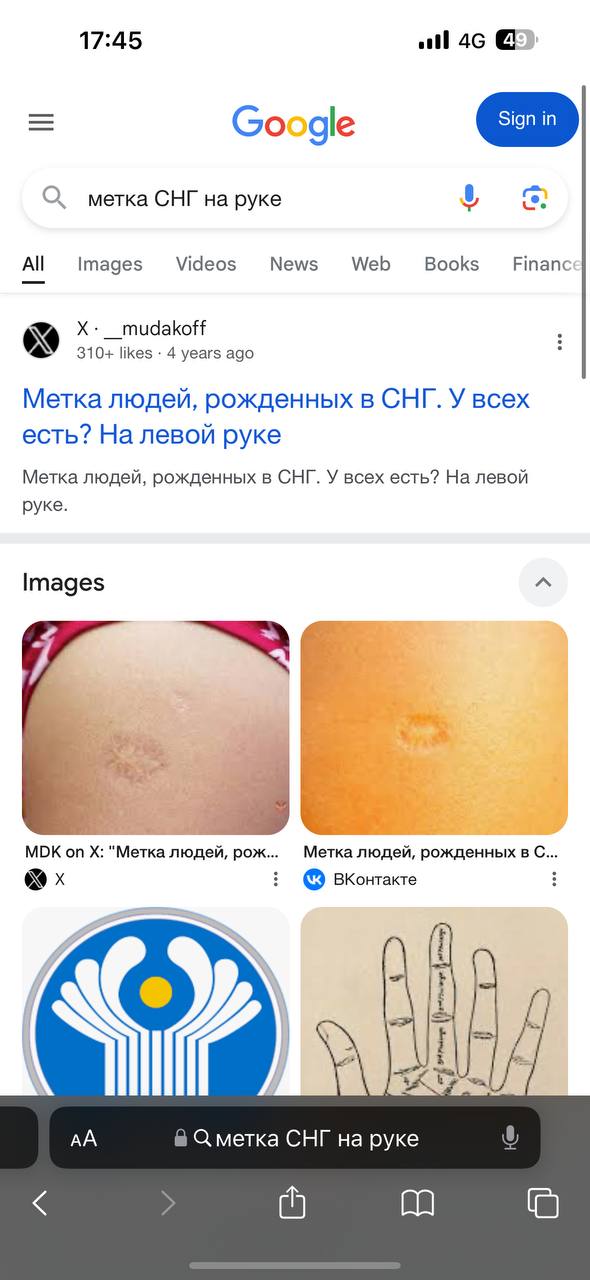 17:45 all [4 Google 8 метка СНГ на руке Images Videos News Web Books Financ 310+ likes 4 years ago Метка людей, рожденных в СНГ. У всех есть? На левой руке Метка людей, рожденных в СНГ. У всех есть? Н
