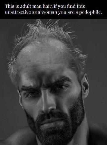 This is adult man hair, if you find this unattractive as a woman you are a pedophile.