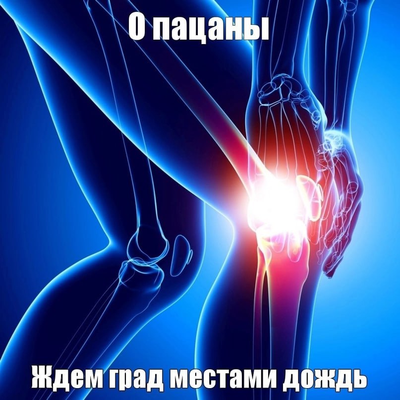 ждем рад местами дождь