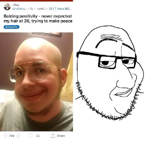 r/ftm у/гаНецу... 2у i.redd.it 26 since 9/2... Balding positivity never expected my hair at 26, trying to make peace OtherPic 7 А 706 32 Share