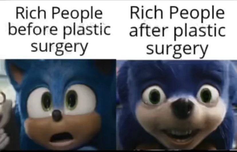 Rich People Rich People before plastic after plastic surgery surgery