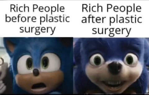 Rich People Rich People before plastic after plastic surgery surgery