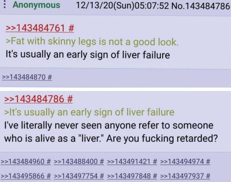 Anonymous 12/13/20(Sun)05:07:52 No.143484786 >>143484761 >Fat with skinny legs is not a good look. It's usually an early sign of liver failure >>143484870 >>143484786 >It's usually an early sign of li