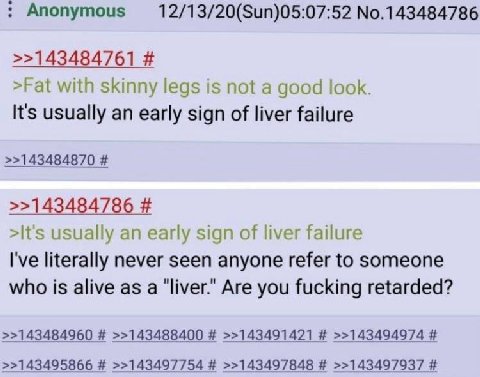Anonymous 12/13/20(Sun)05:07:52 No.143484786 >>143484761 >Fat with skinny legs is not a good look. It's usually an early sign of liver failure >>143484870 >>143484786 >It's usually an early sign of li