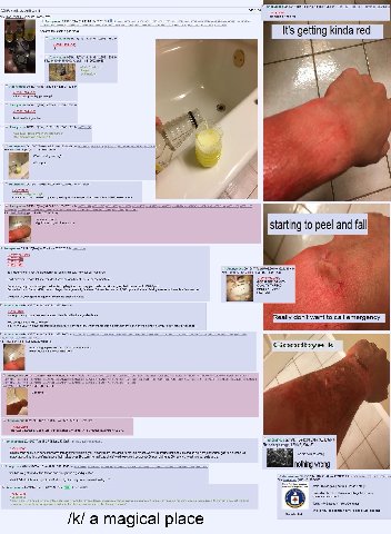Anonymous 09/19/17(Tue)14:11:48 32] [Bottom] 803/150 Its getting kinda red IMG_8579 jpa (371 О Anonymous 09/19/17(Tue)13:45:03 №.35211774 9 95012060 5535242510 35212004 2995012016 35213035 35213704 ‘A