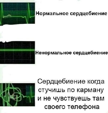 Нормальное сердцебиение Ненормальное сердцебиение Сердцебиение когда стучишь по карману и не чувствуешь там своего телефона