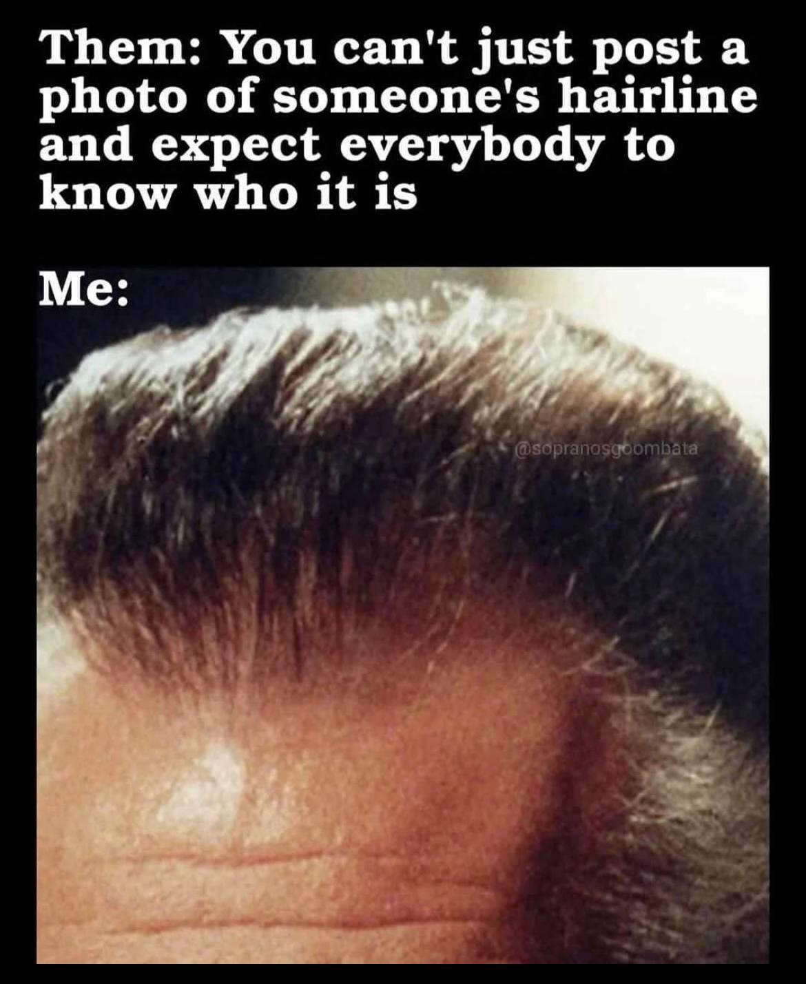 Them: You can't just post а photo of someone's hairline and expect everybody to know who it is Me: 4 4