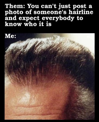 Them: You can't just post а photo of someone's hairline and expect everybody to know who it is Me: 4 4