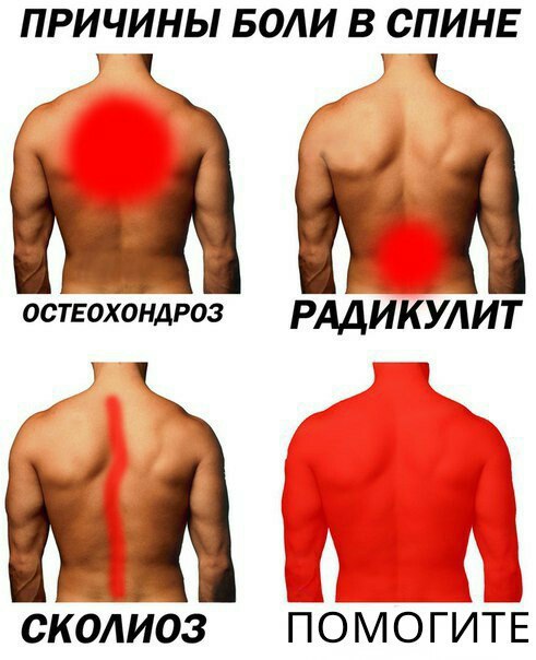 ПРИЧИНЫ БОЛИ В СПИНЕ ОСТЕОХОНДРОЗ РАДИКУЛИТ СКОЛИОЗ ПОМОГИТЕ