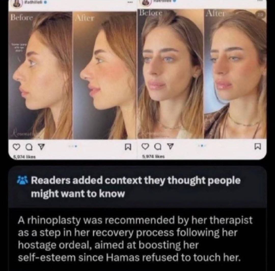 за) 4 9 от A я Readers added context they thought people might want to know Arhinoplasty was recommended her therapist as a step in her recovery process following her hostage ordeal, aimed at boosting