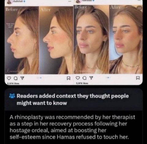 за) 4 9 от A я Readers added context they thought people might want to know Arhinoplasty was recommended her therapist as a step in her recovery process following her hostage ordeal, aimed at boosting