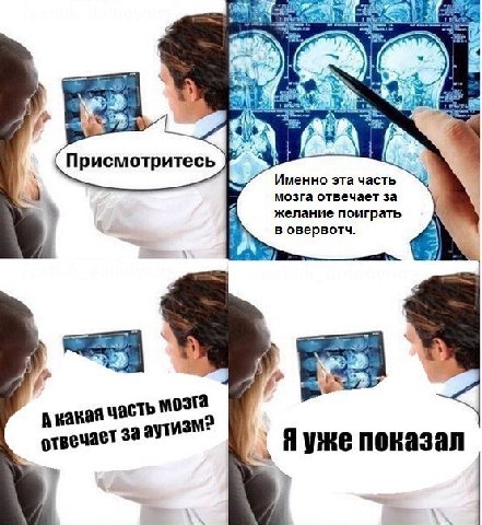 Присмотритесь Именно эта часть мозга отвечает за желание поиграть в овервотч. А кака ячасть мозга отвечает за я уже показал