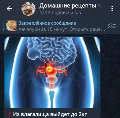 Домашние рецепты подписчиков Закреплённое сообщение 5 Хачапури за 15 минут Открыть реце... Из влагалища выйдет до