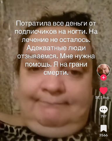 Потратила все деньги от подписчиков на ногти. На лечение не осталось. Адекватные люди отзываемся. Мне нужна помощь. Я на грани С смерти. 58,5 тыс. 797 2566