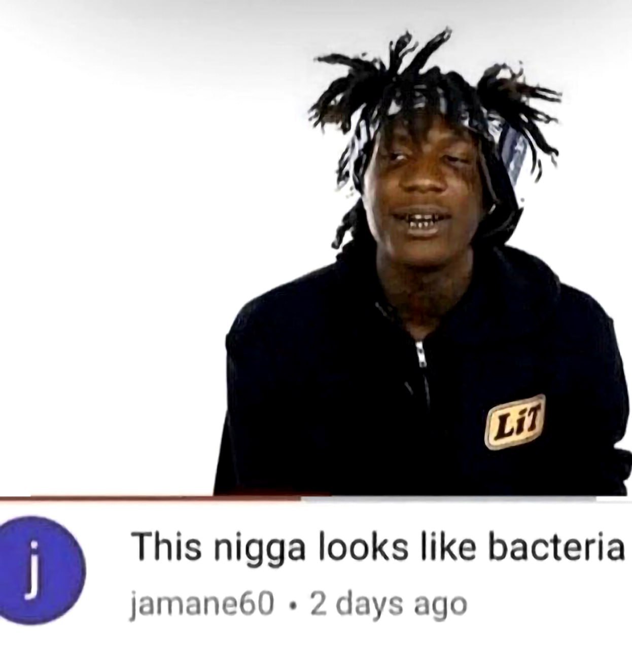 This nigga looks like bacteria jamane60 2 days ago