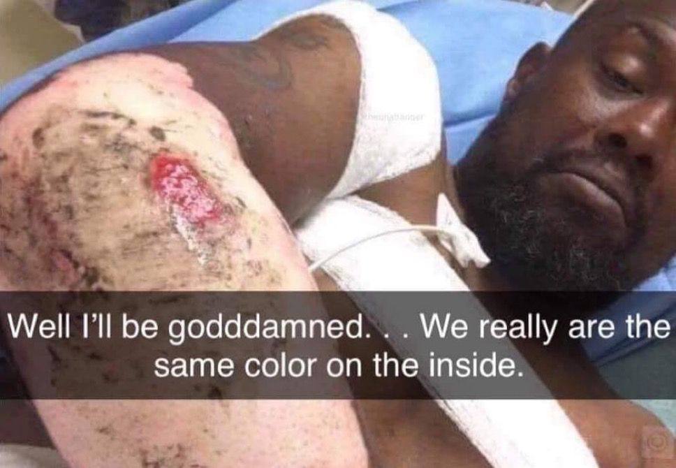 Well be We really are the same color on the inside.